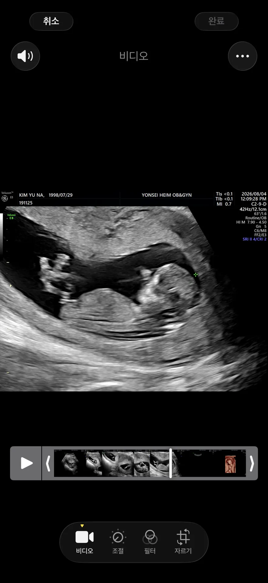 12주차 2일 성별 각도법 봐주세요:) 1