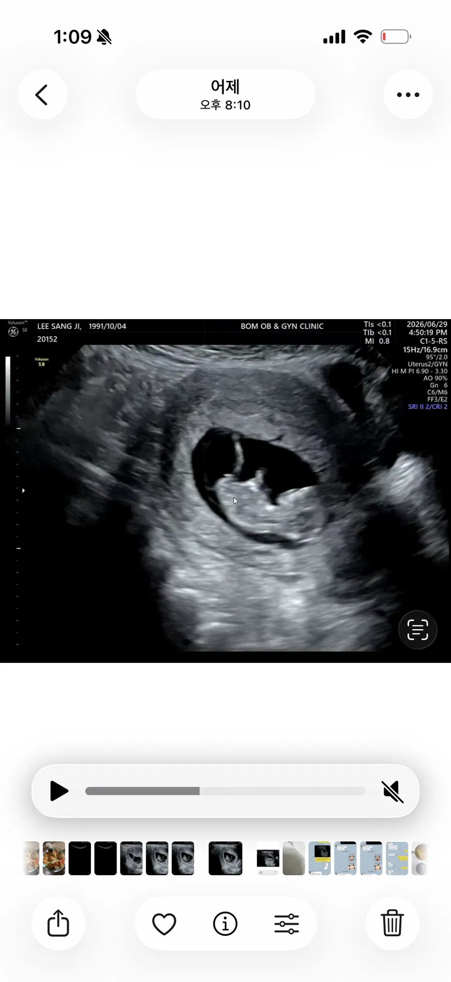 11주 5일