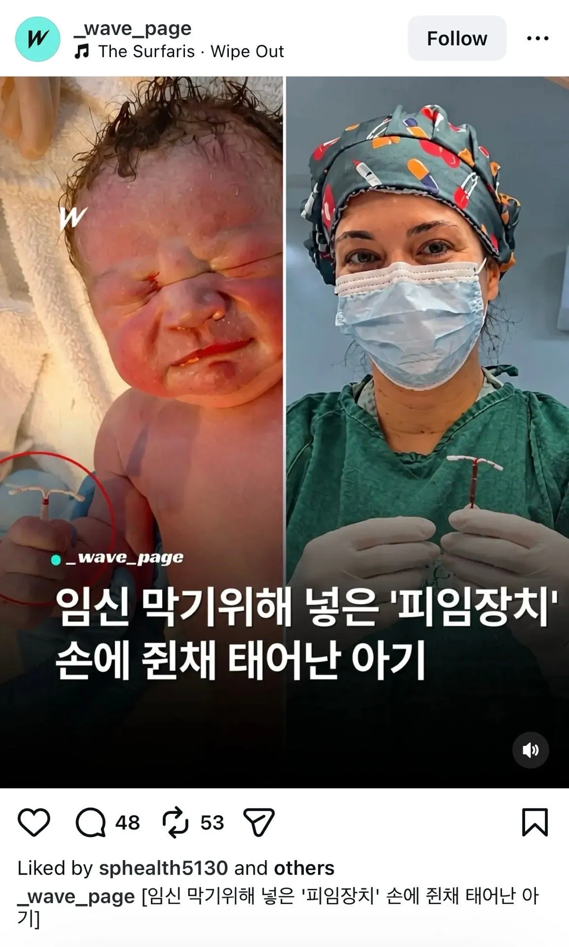 둘째 피임 조심..^^