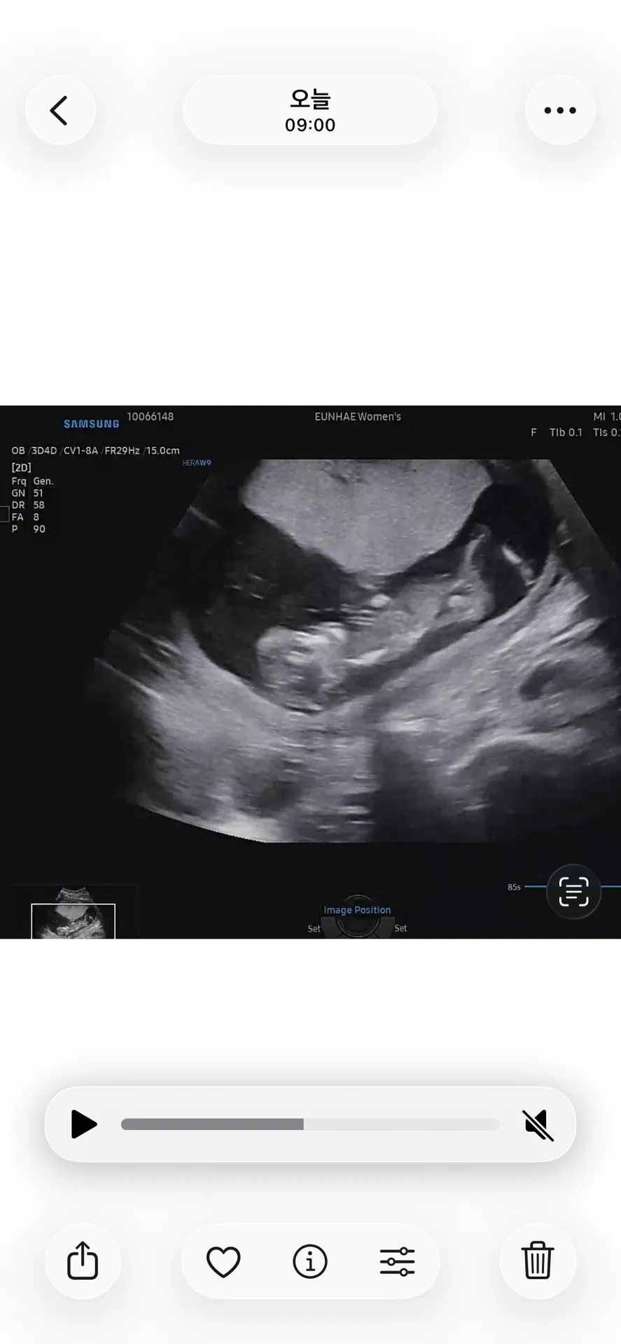 (12주 6일차)와이프랑 같이 1차 기형아검사를 하고 왔는데 대학병원 소견서를 받아왔네요 4
