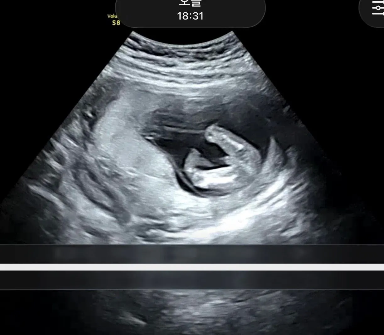 14주차 🌶️일까요 탯줄일까요🤔🤔 3