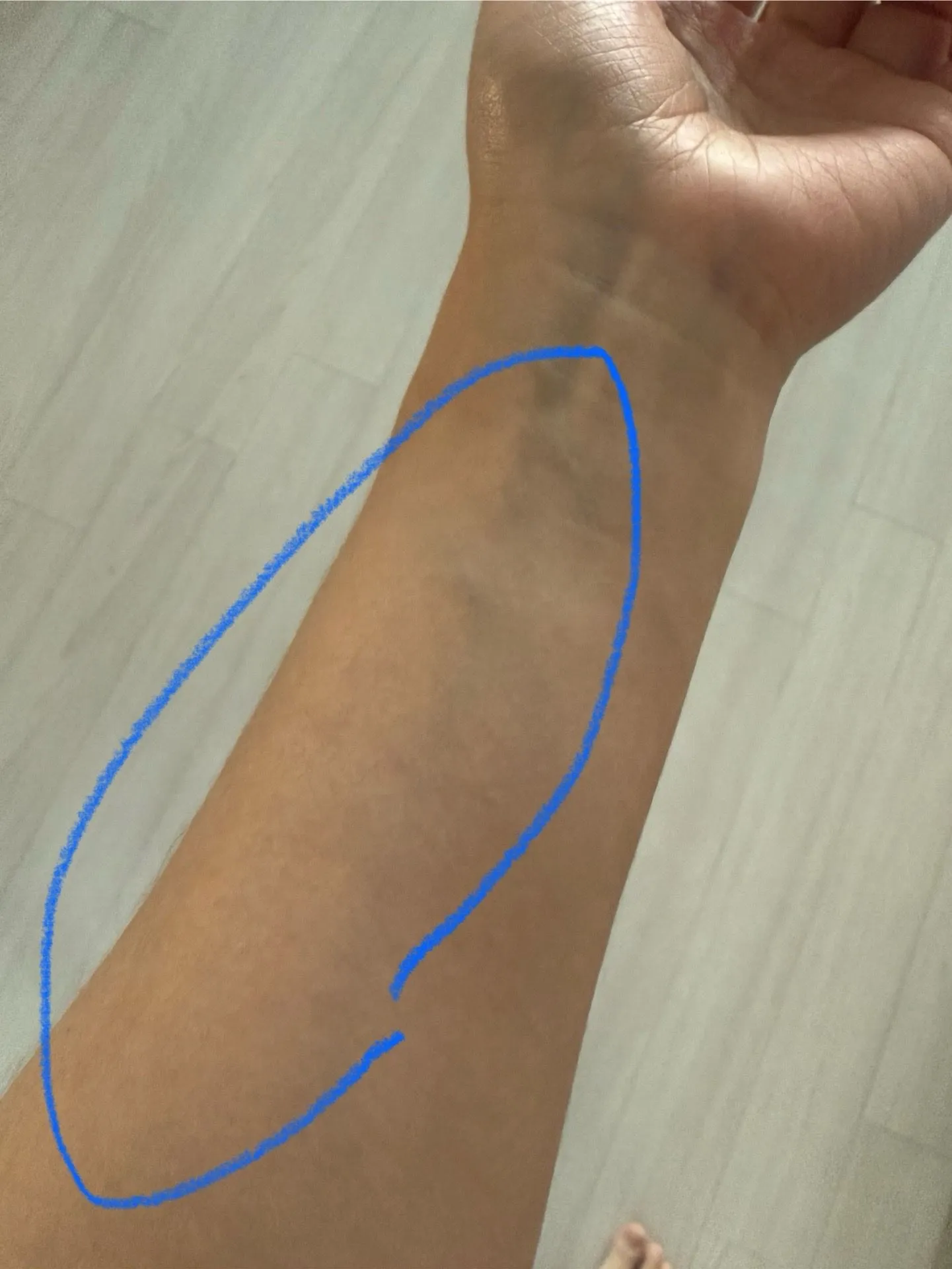 19주차 팔 아프신분 계실까요?