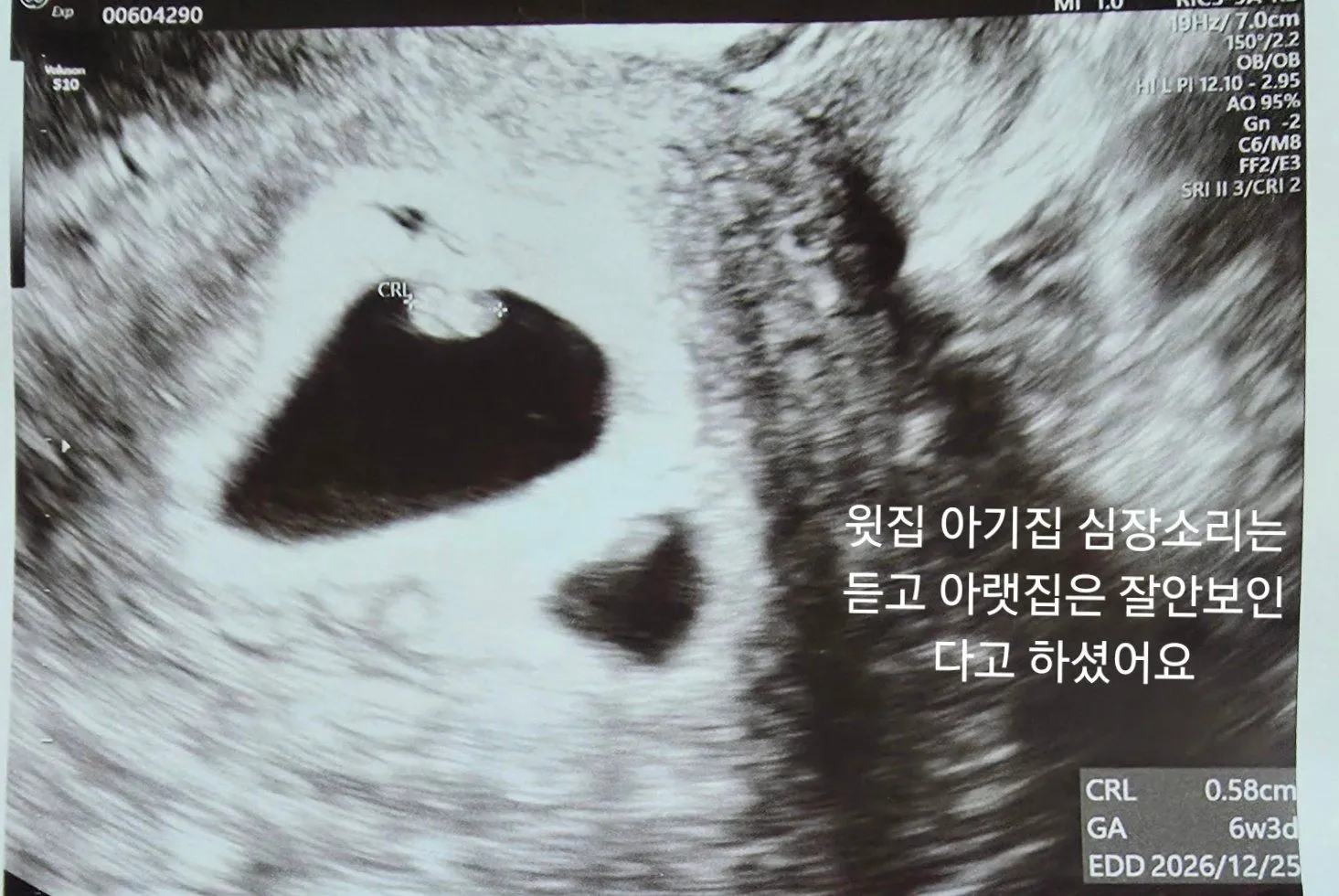 임신선배님들ㅠㅠ 2