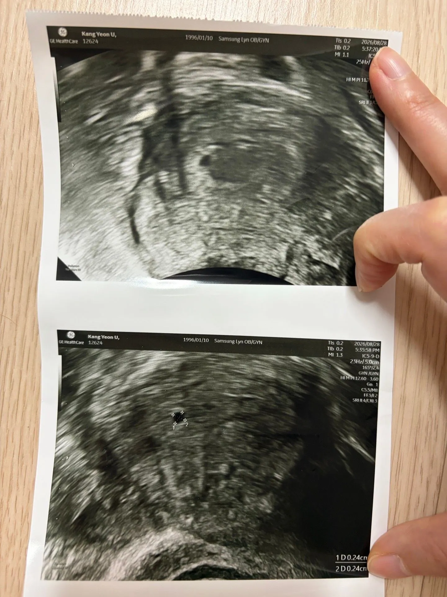 임신테스트기 수치 정체기 2