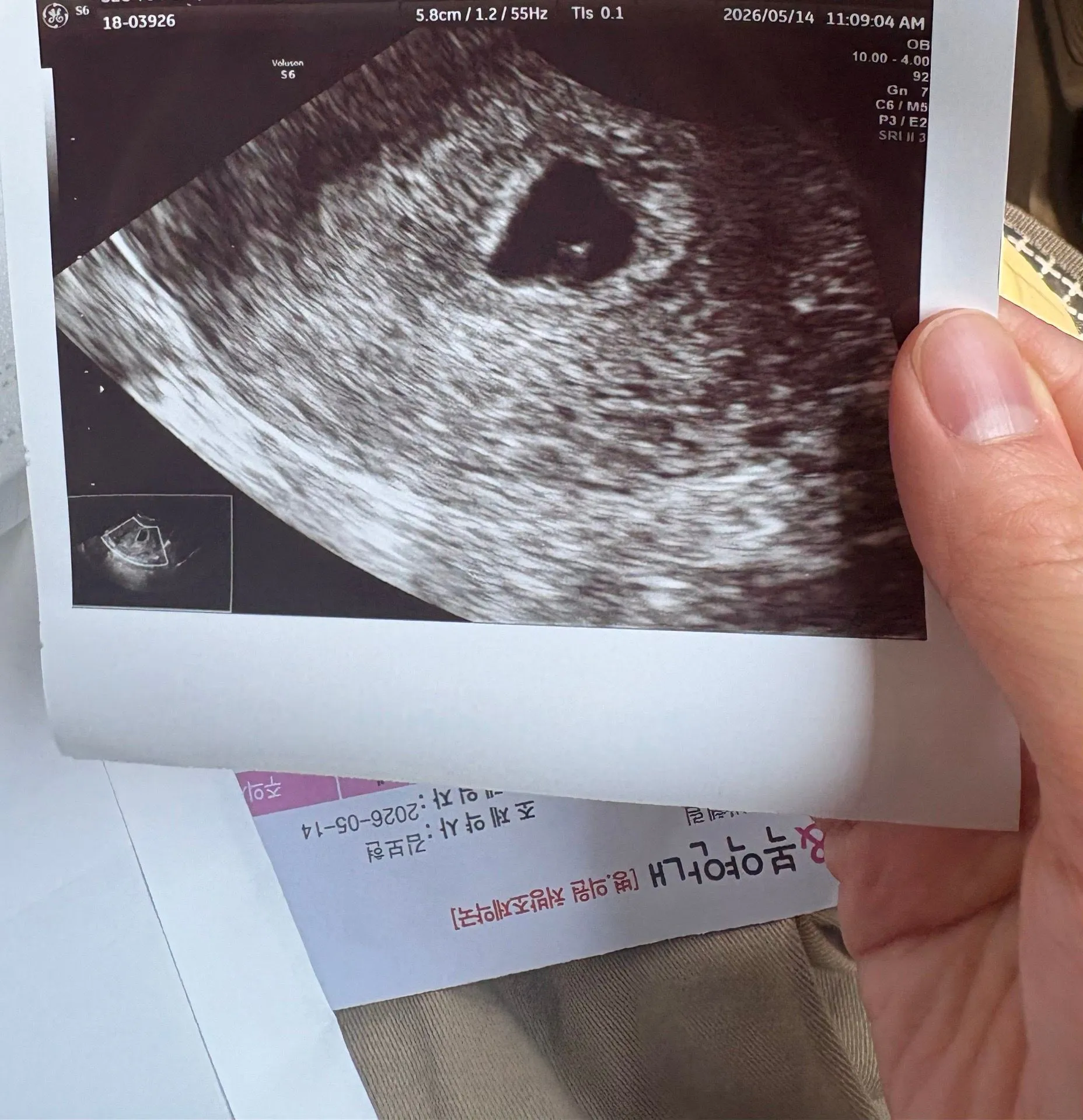 5주차 초음파 보고왔는데 