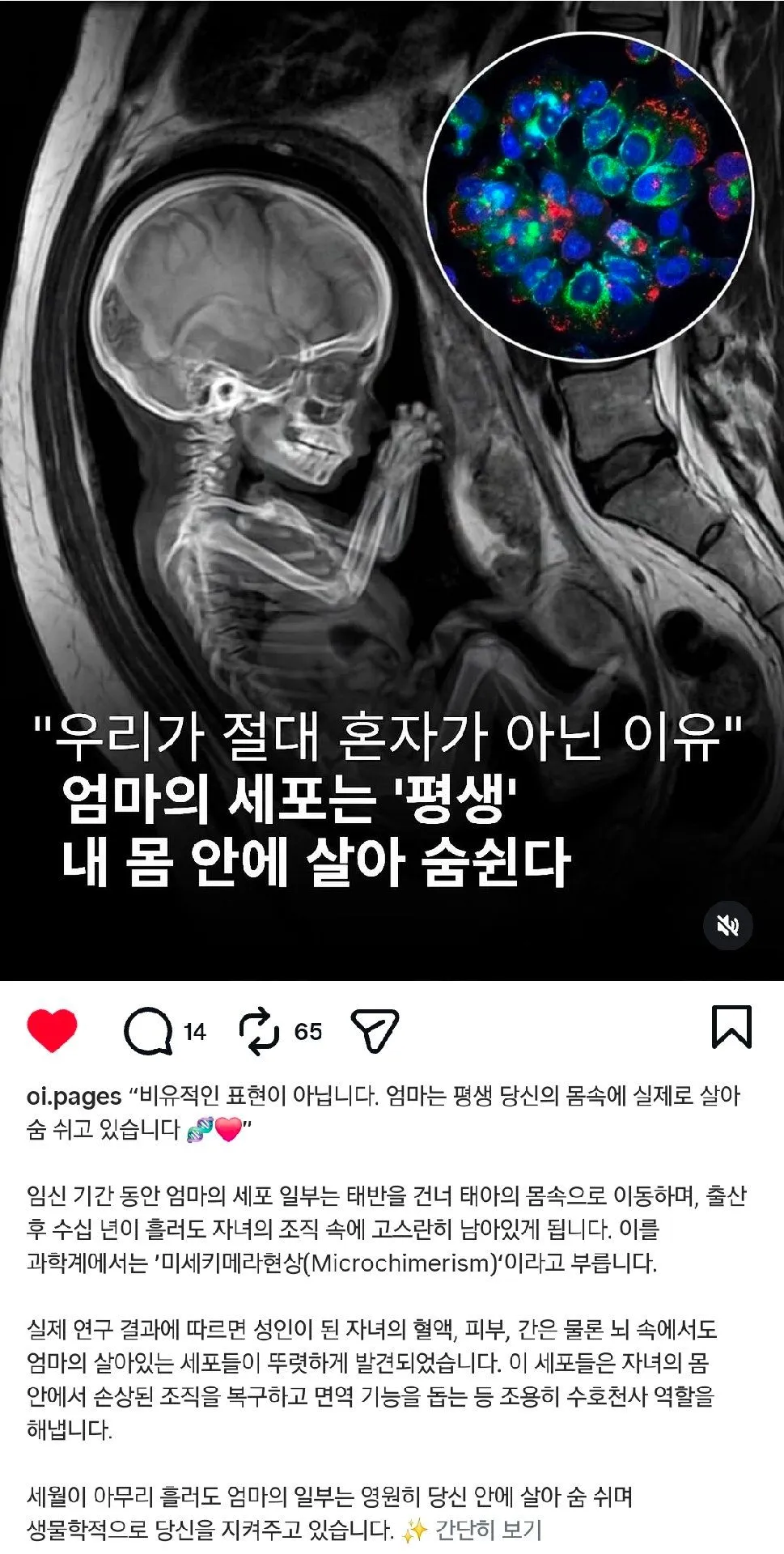 아이는 엄마와 영원히 함께한대요.♡