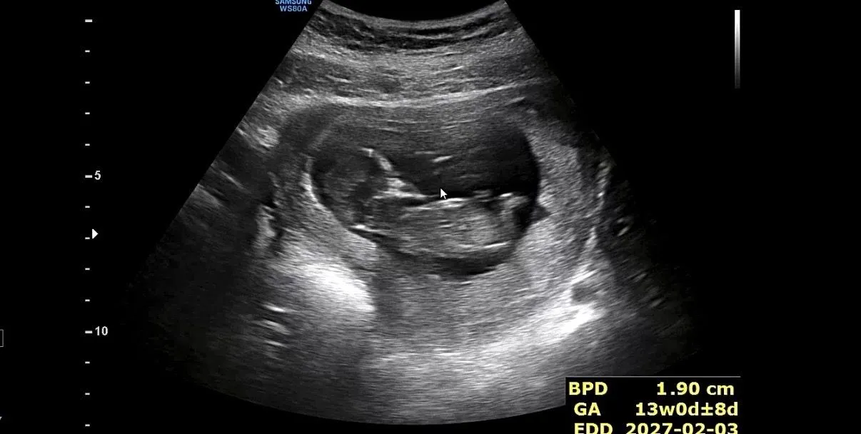 12 주차 예비 엄마예요. 저희 양말이는 딸일까요? 아들일까요? 1
