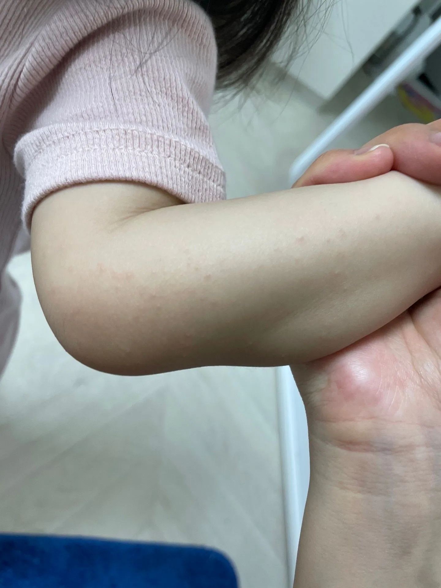 혹시 수족구 일까요???? 2