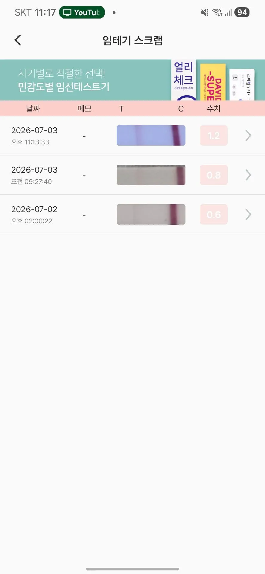 신선이식 7일차