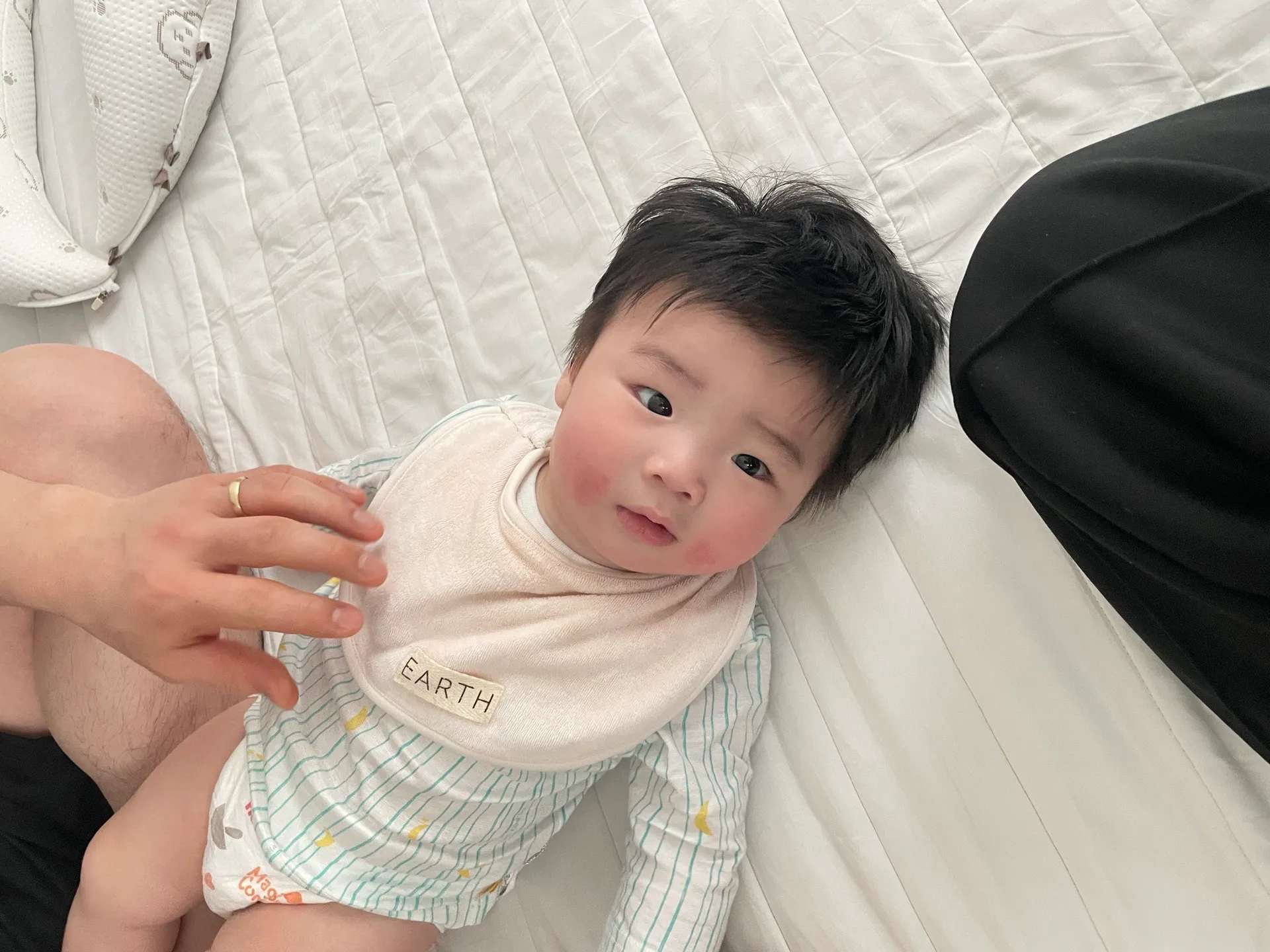 온몸이 이래요 7개월아기 어쩜좋나요 2