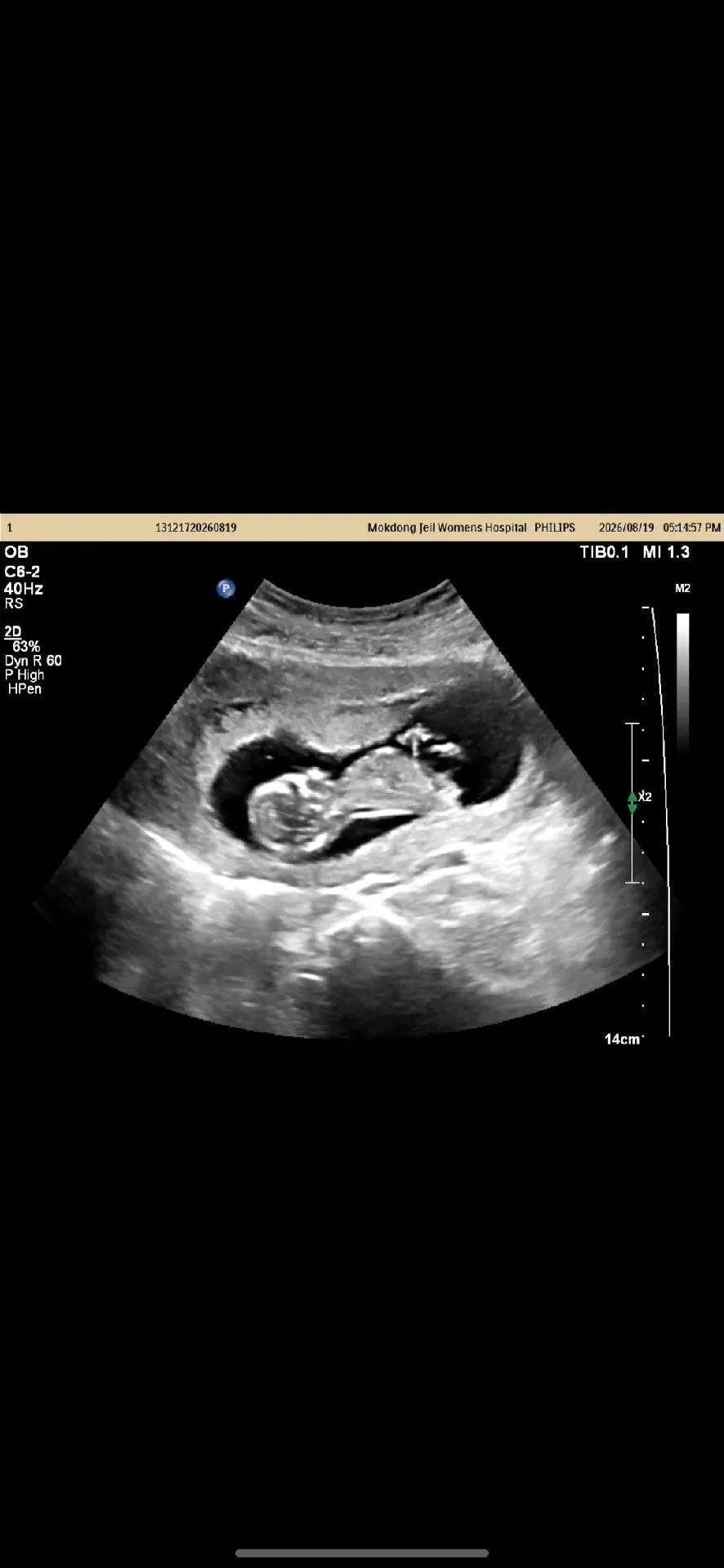 각도법 봐주세요  12주 5일이에요 3
