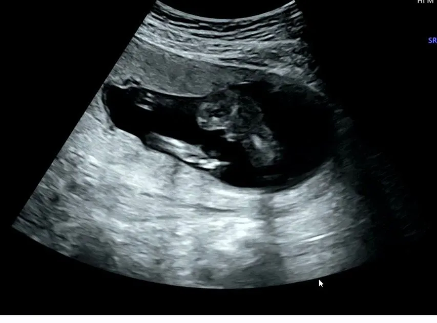 15주 5일 다리 사이 같이 봐주세요!! 4