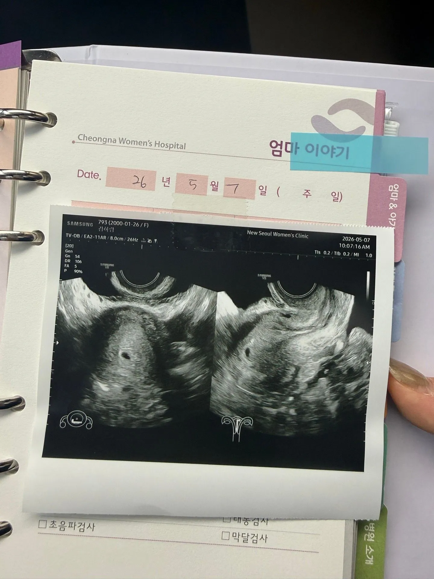 6주6일 예정일 1/1 일줄알고 병원방문..아기집크기 봐주세여  1