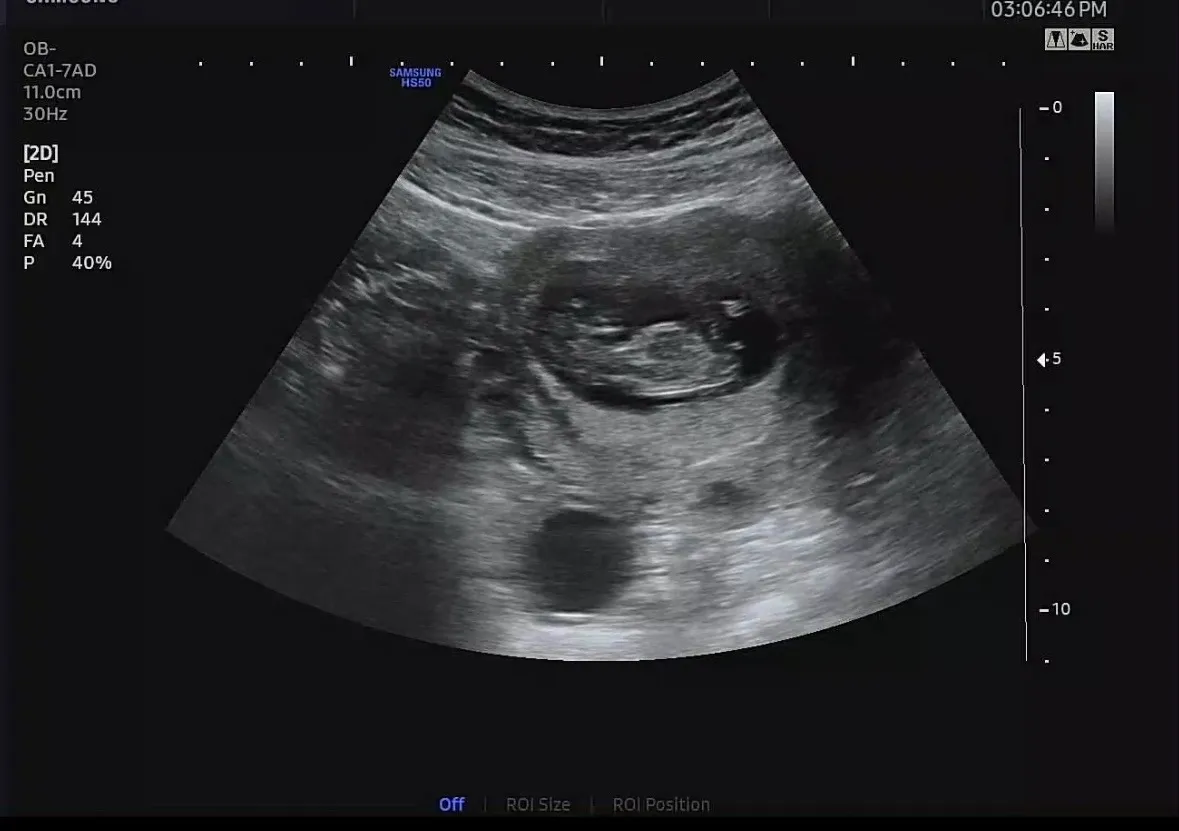 각도법..봐주실 분 계실까용? 2
