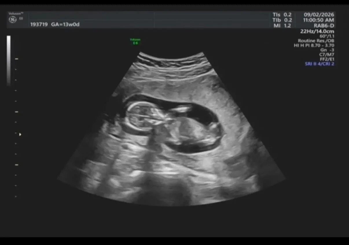 13주 1일차 성별 그리고 양수양이.. 1