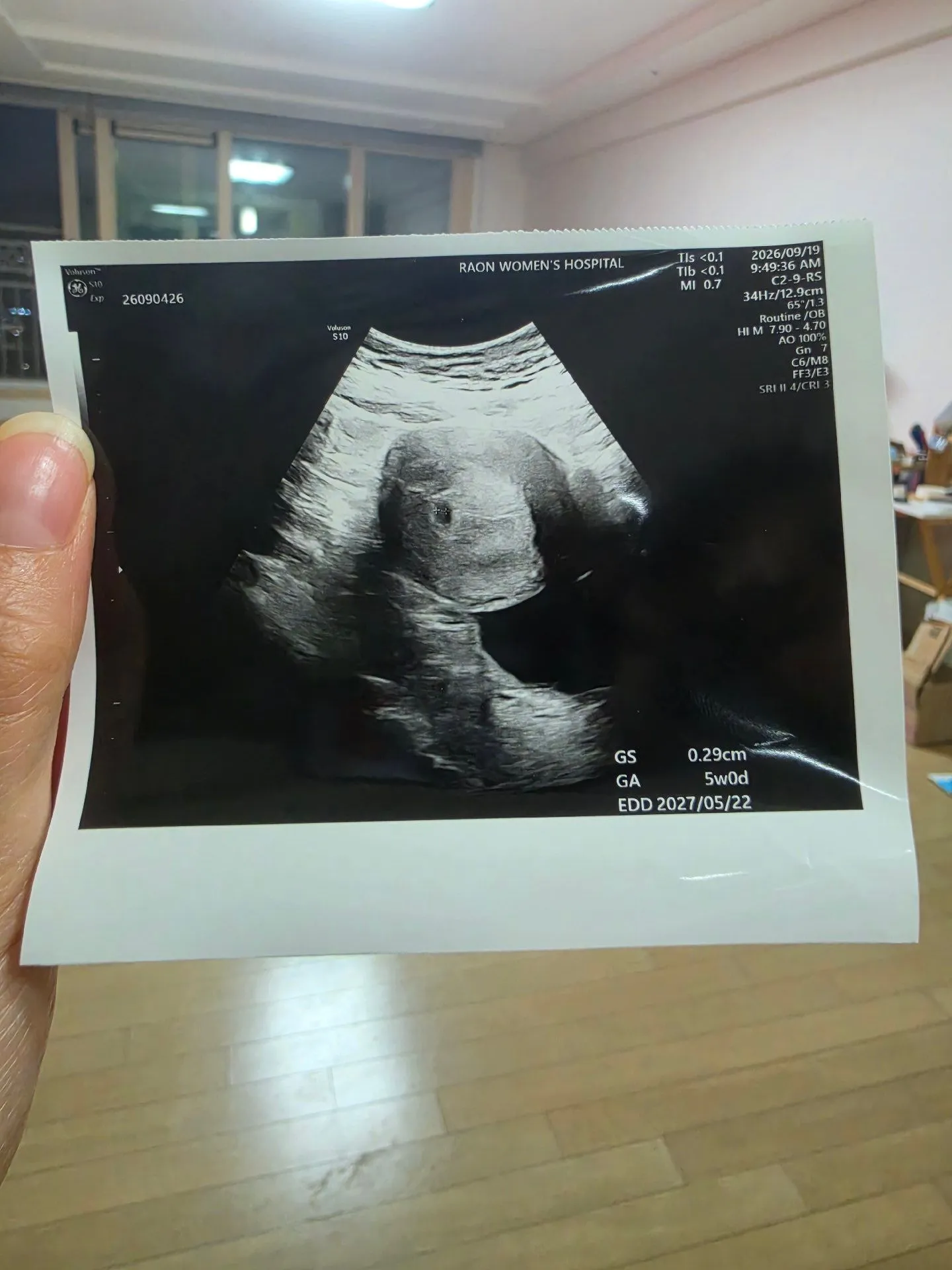 아기집 너무 작은거같아걱정이에요