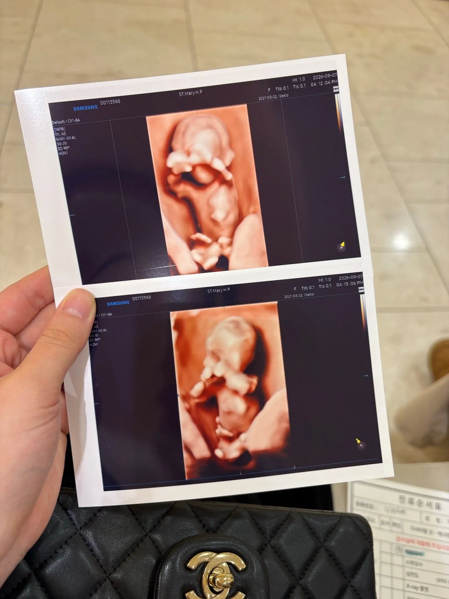 12주 0일 각도법 봐주실 분 계실까요?👶🏻💕 1