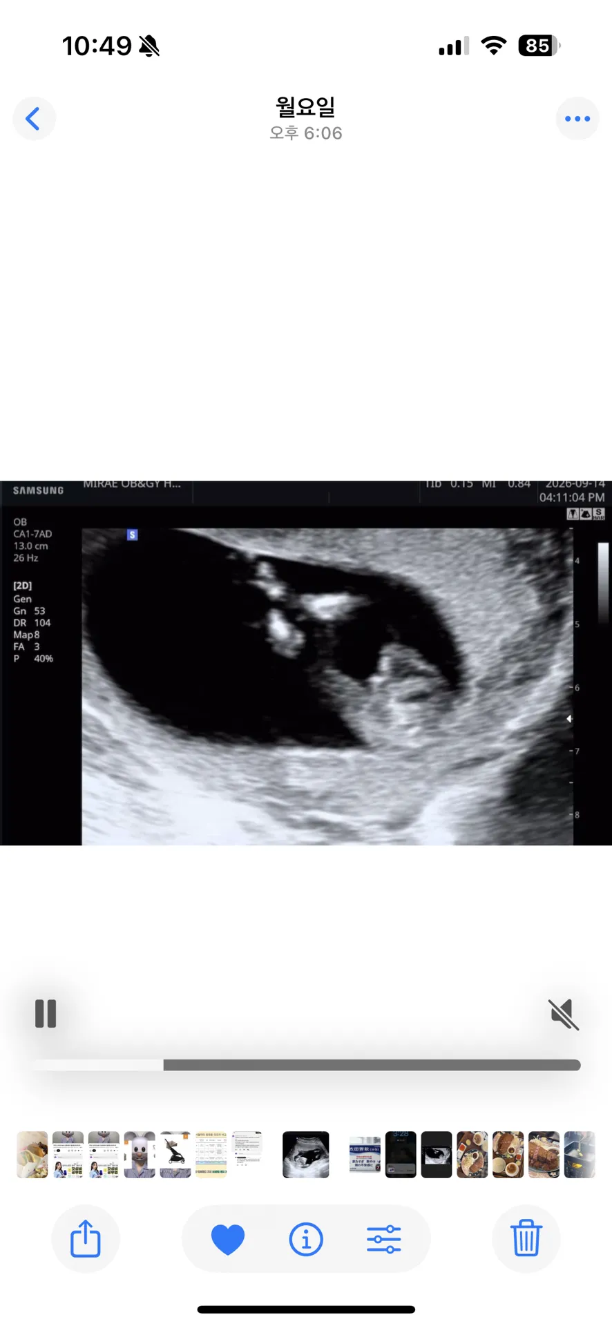 12주6일 성별 각도법 잘 보시는 분 계실까요 ?? 2
