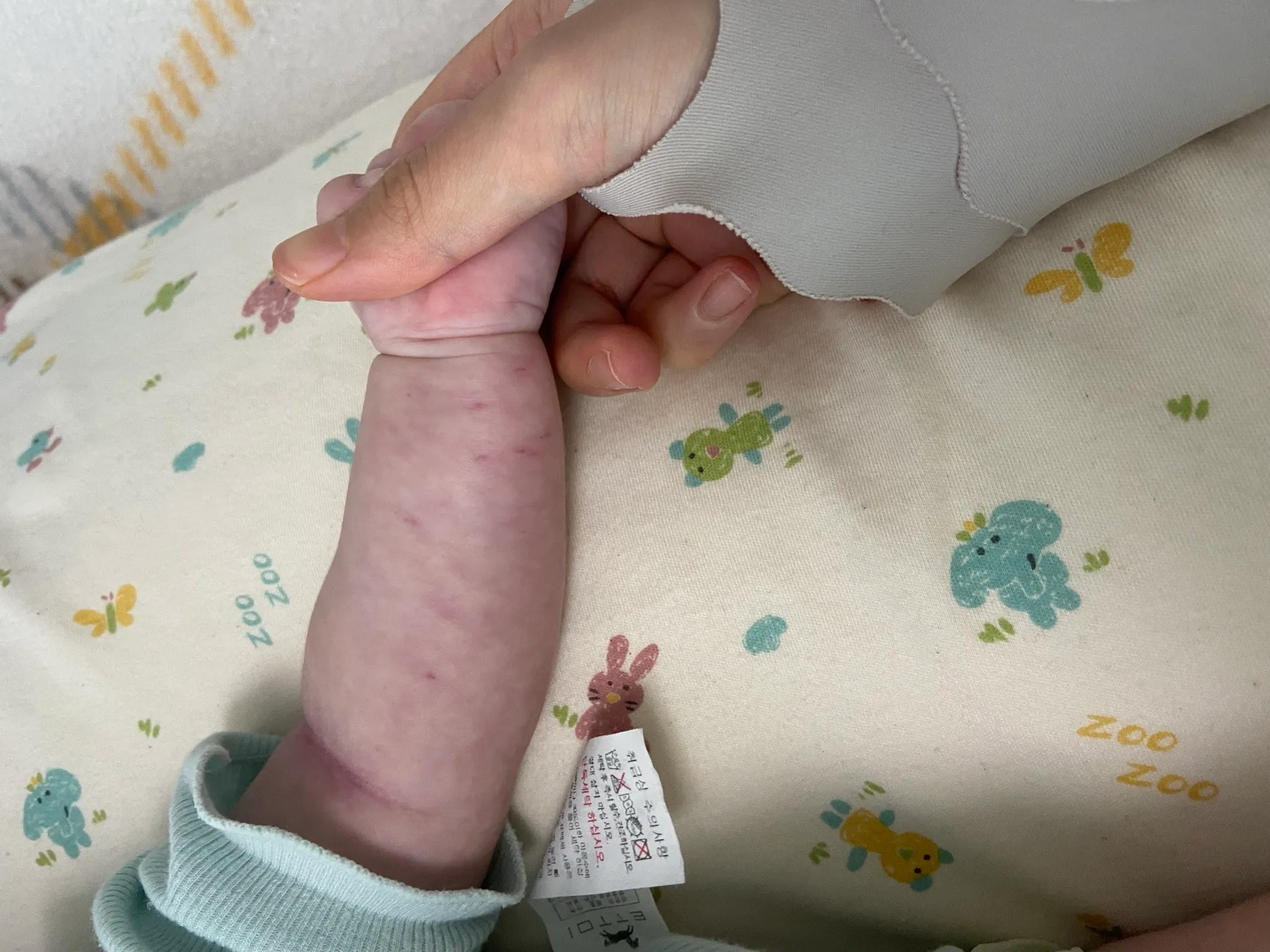 왼쪽팔 발진? 상처?