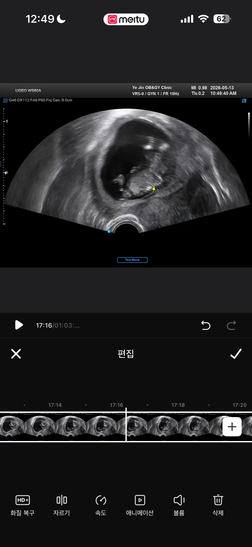아들같지요????!!!! 12주 촘파 투표해주세요💖 1