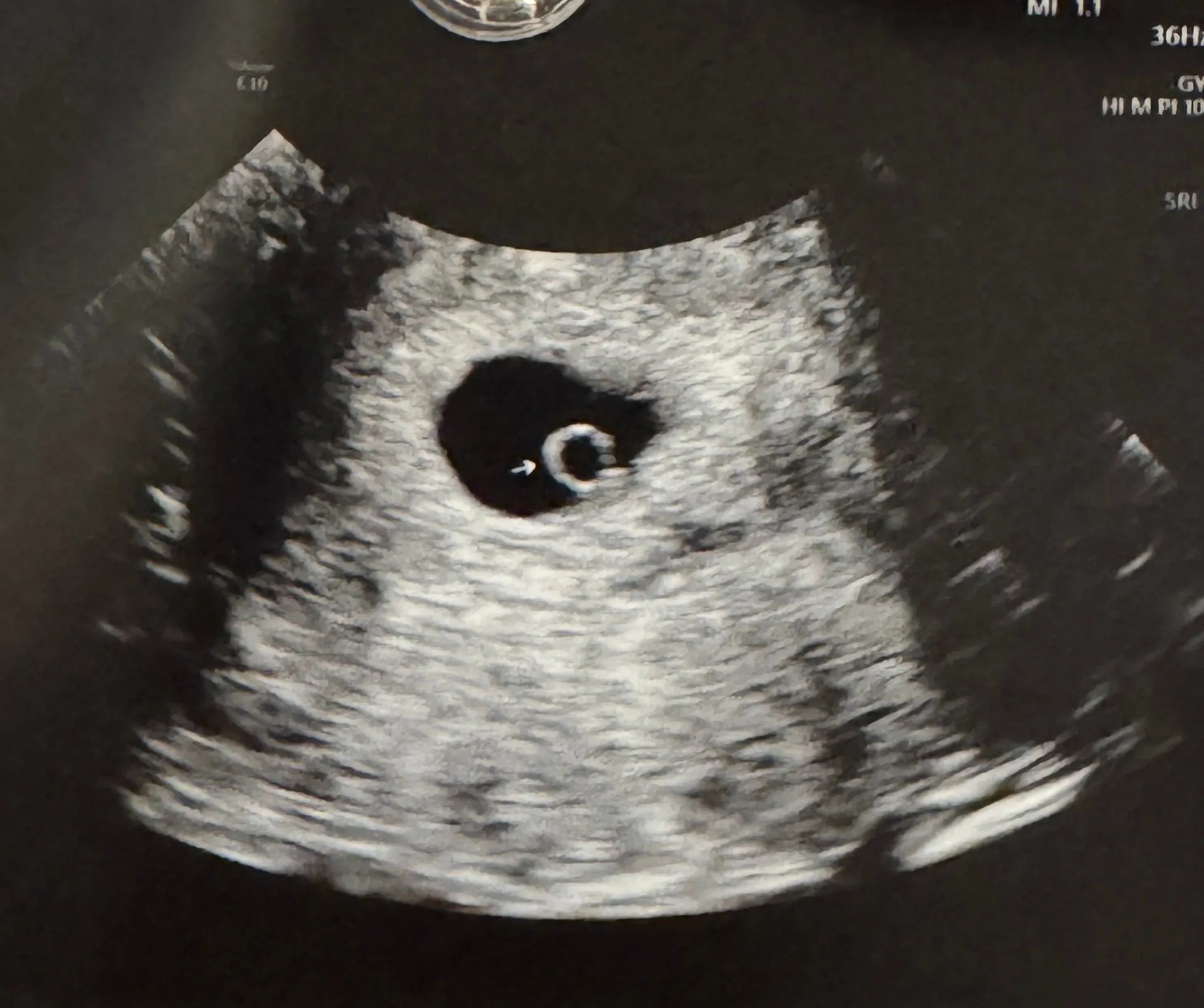 여기에 아기싹이 보이나요?