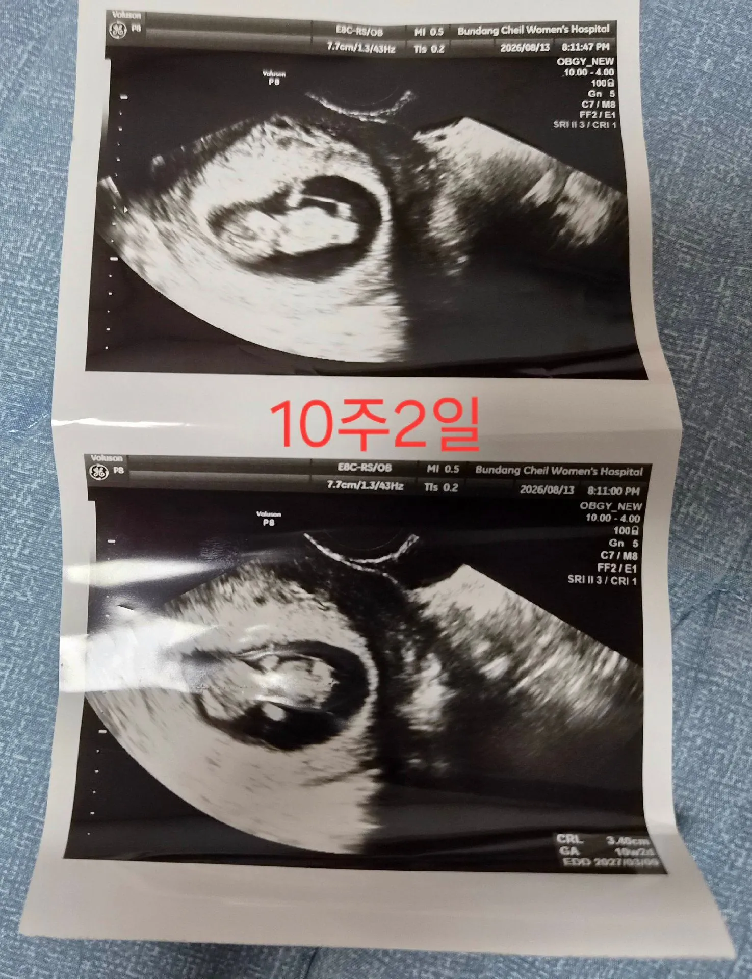10주2일인데 갑자기  분비물도 나오고 배가 뭉쳐서,, 2