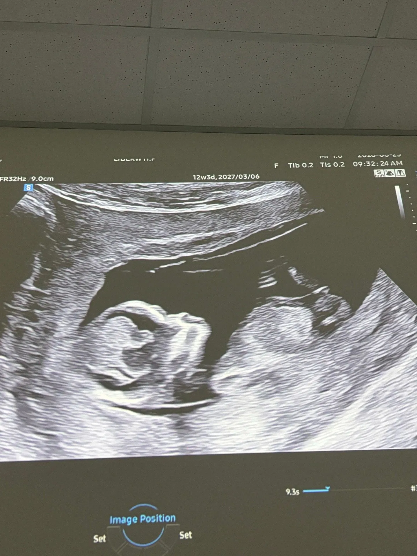 12주차 성별 예측좀 해주세요ㅜ 3