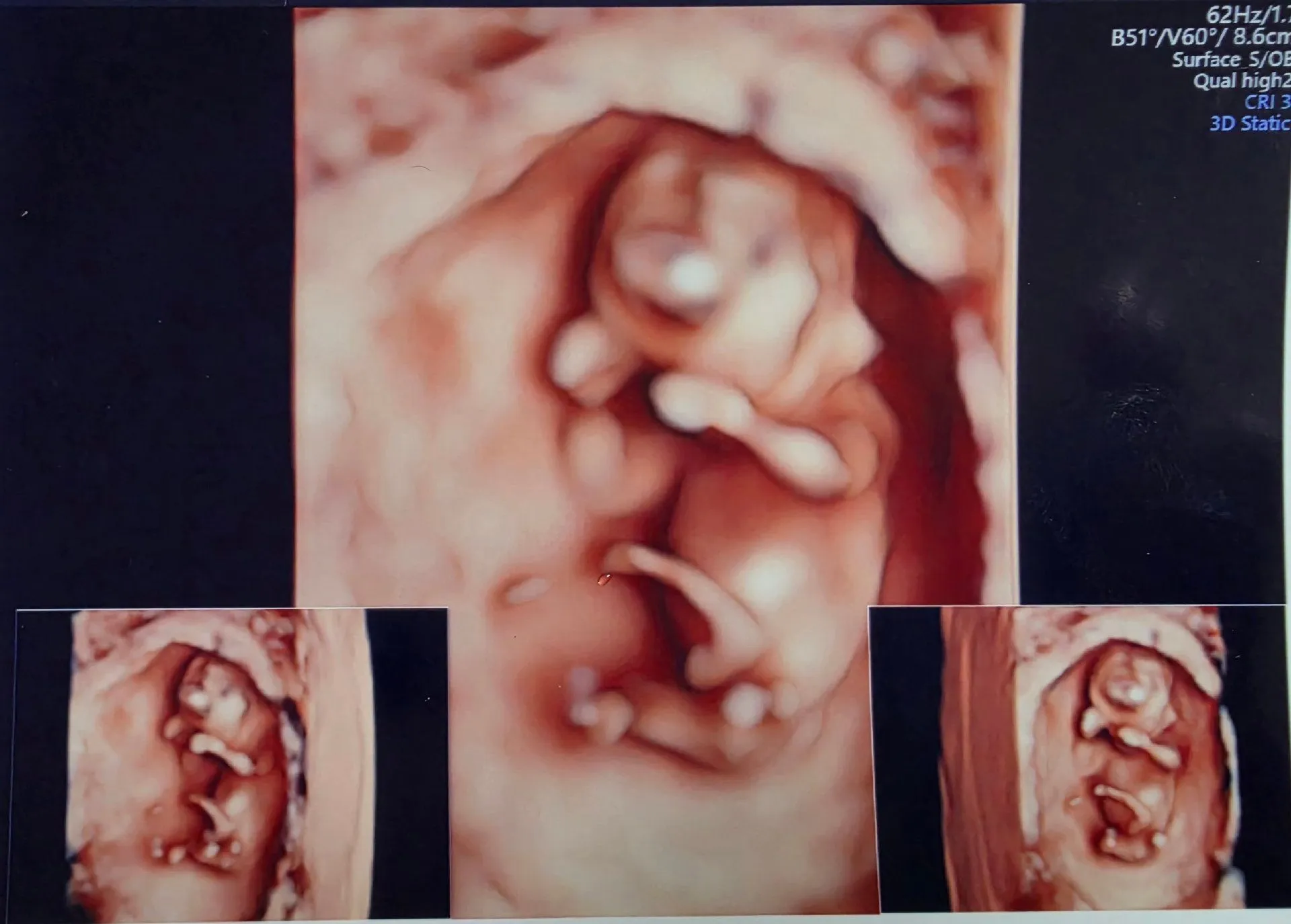 너무 귀여운 11주 아가 👶 3