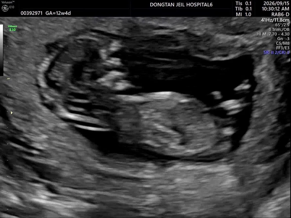 12주 5일 각도법 봐주세요!!👶🏻💛