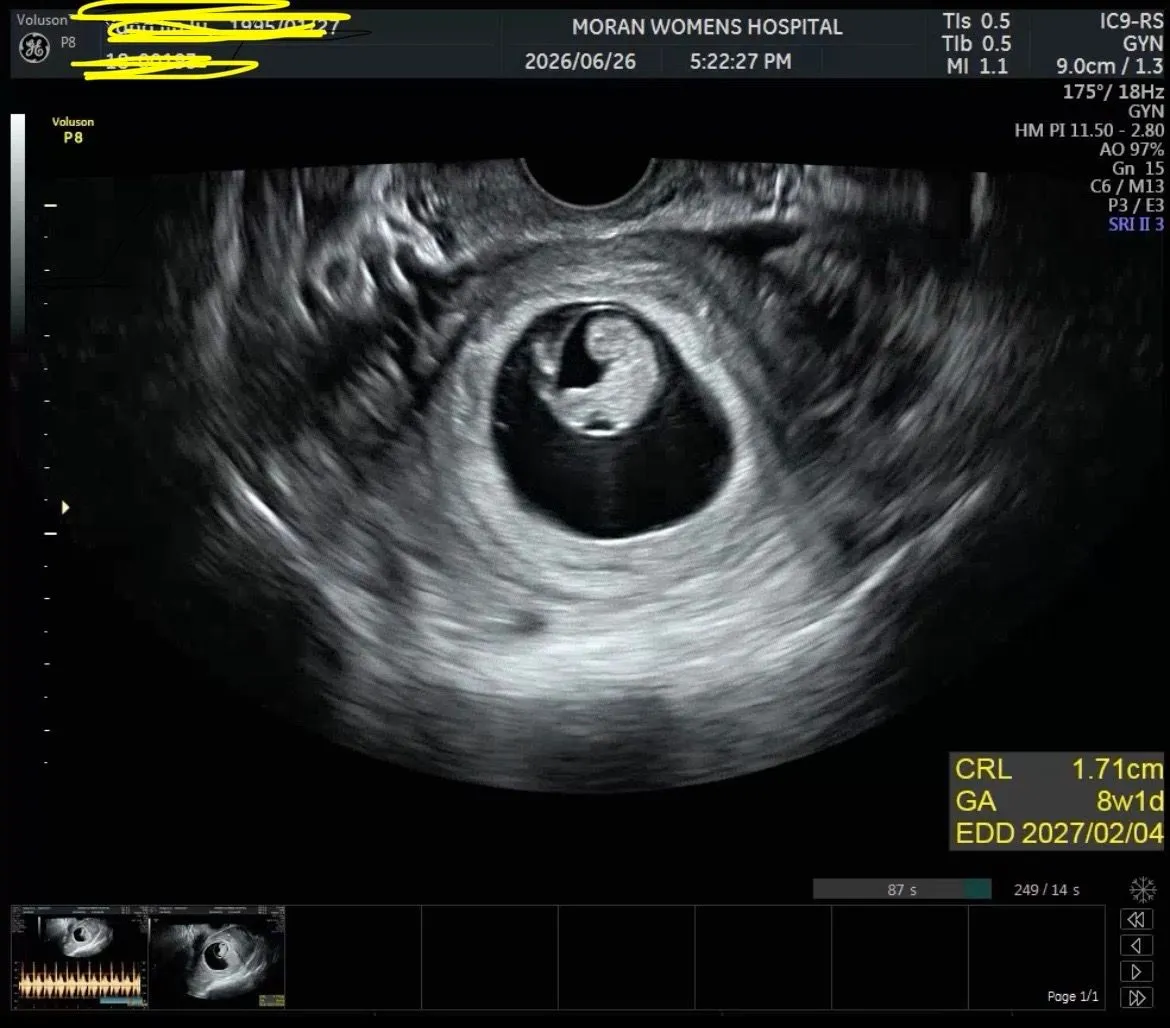 예정일 2월4일 확정났어요!  3