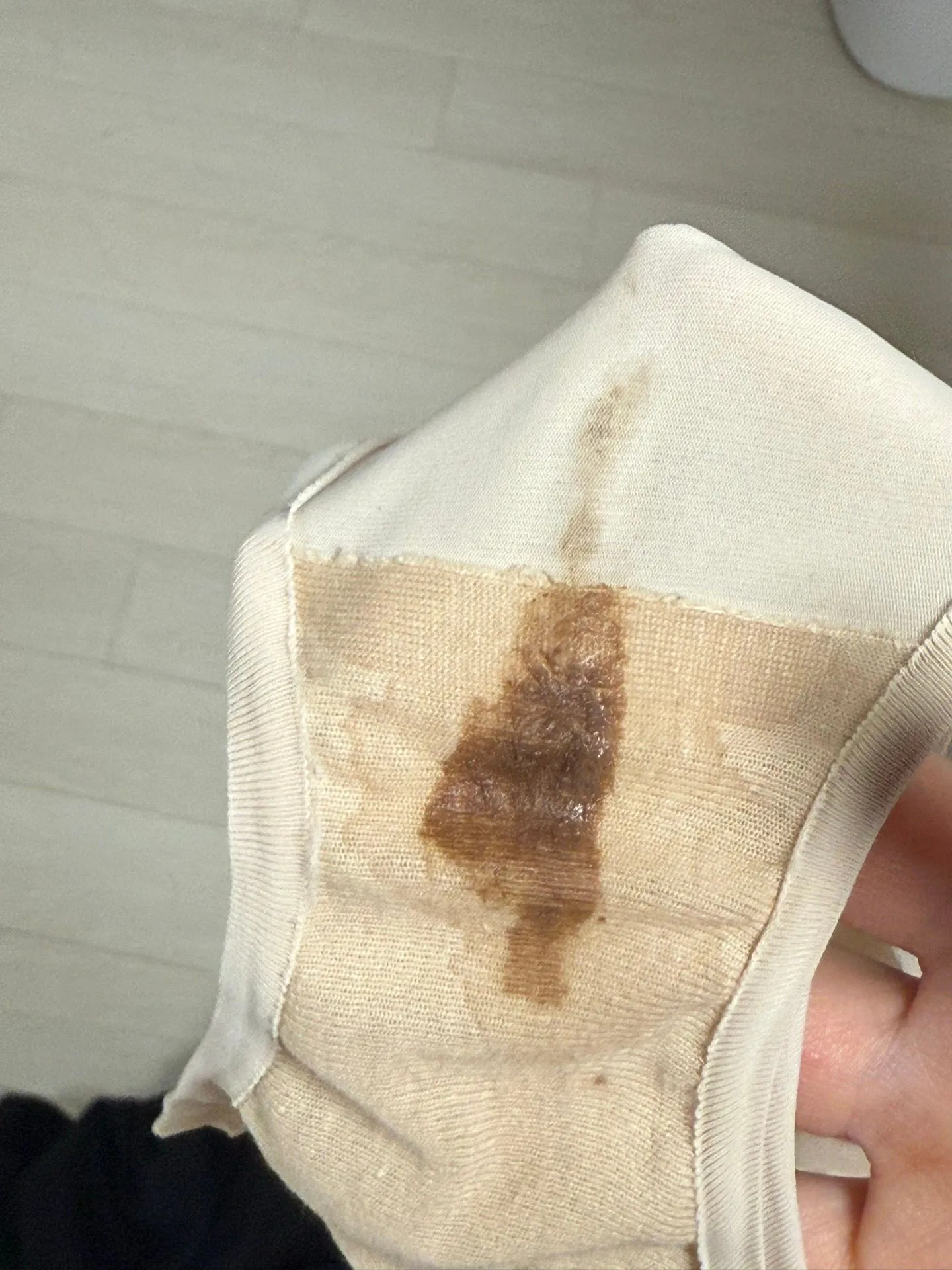 임신6주2일차 갈색혈 사진있음 2