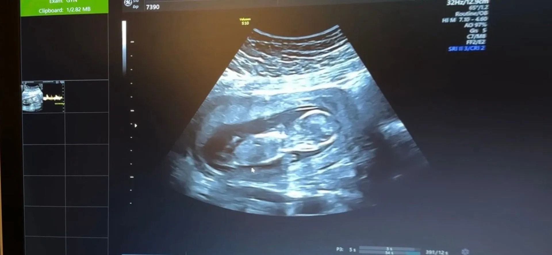 13주1일 각도법 궁금해요 ☺️ 2