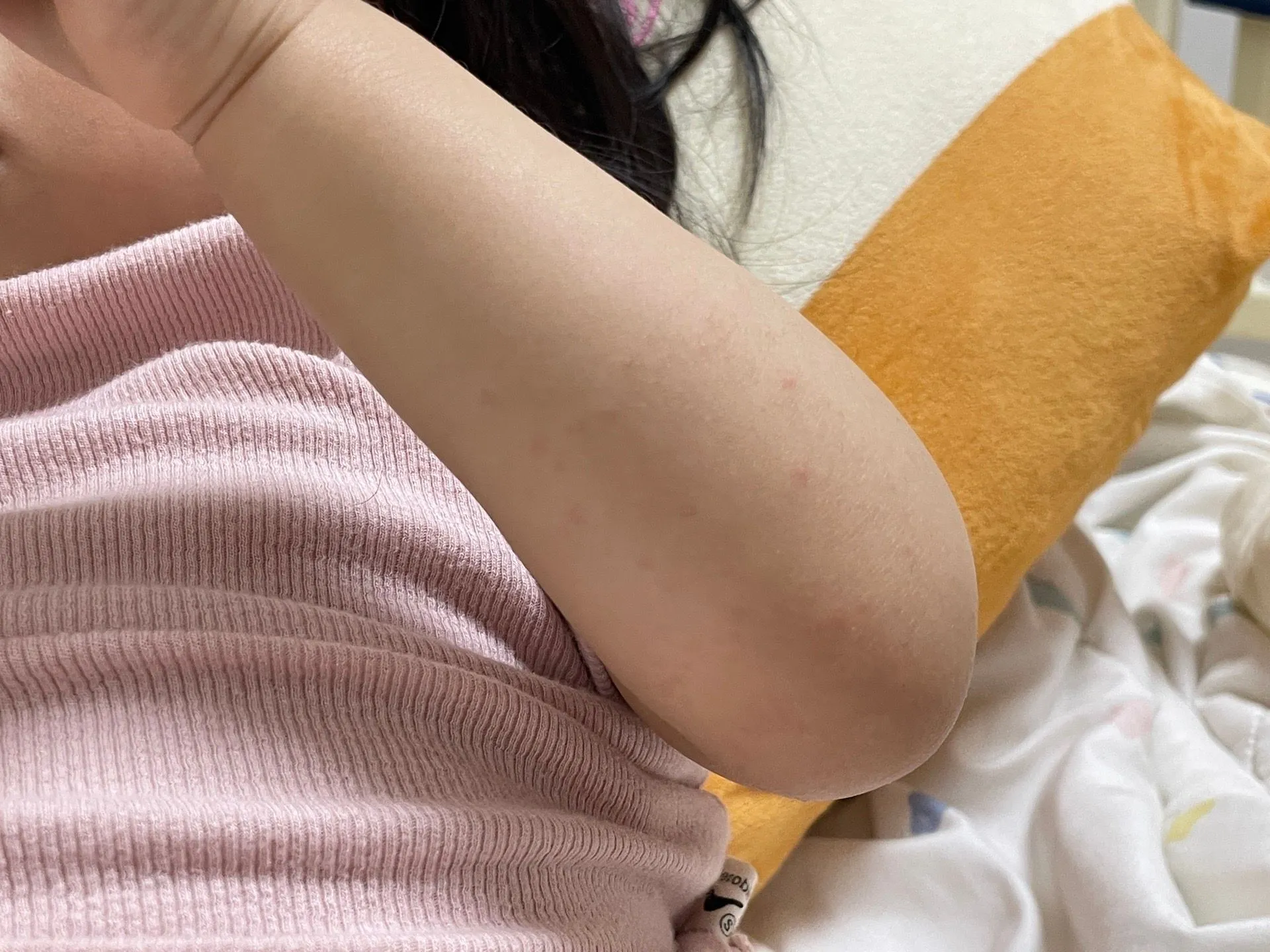 혹시 수족구 일까요???? 1