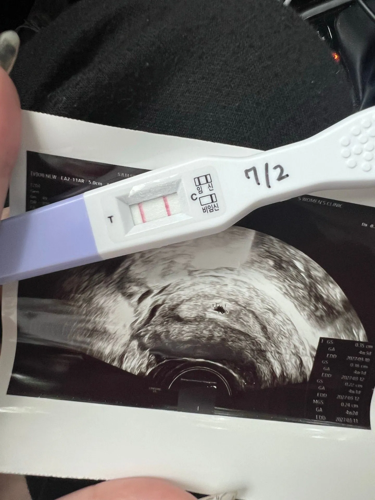 community post image