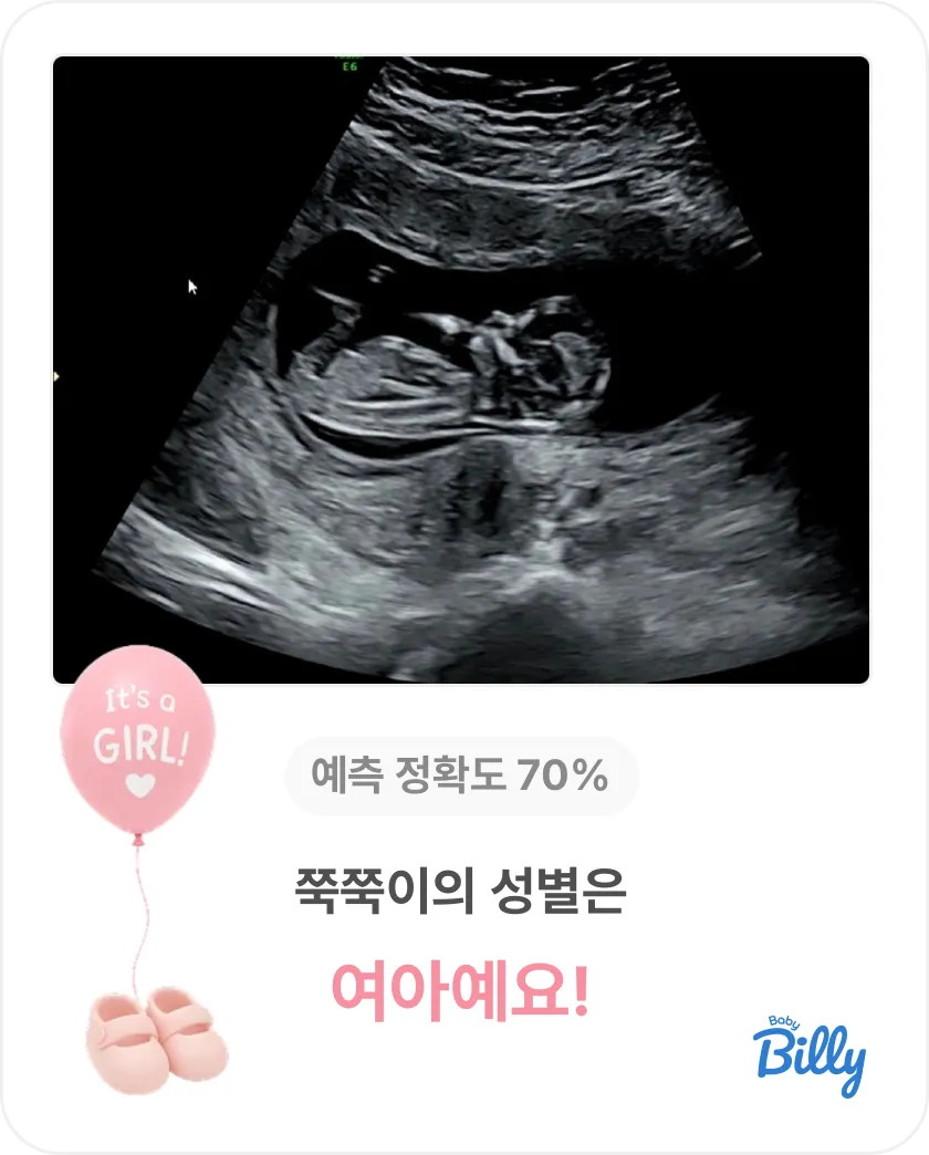 빌리AI 성별 정확도 측정 !