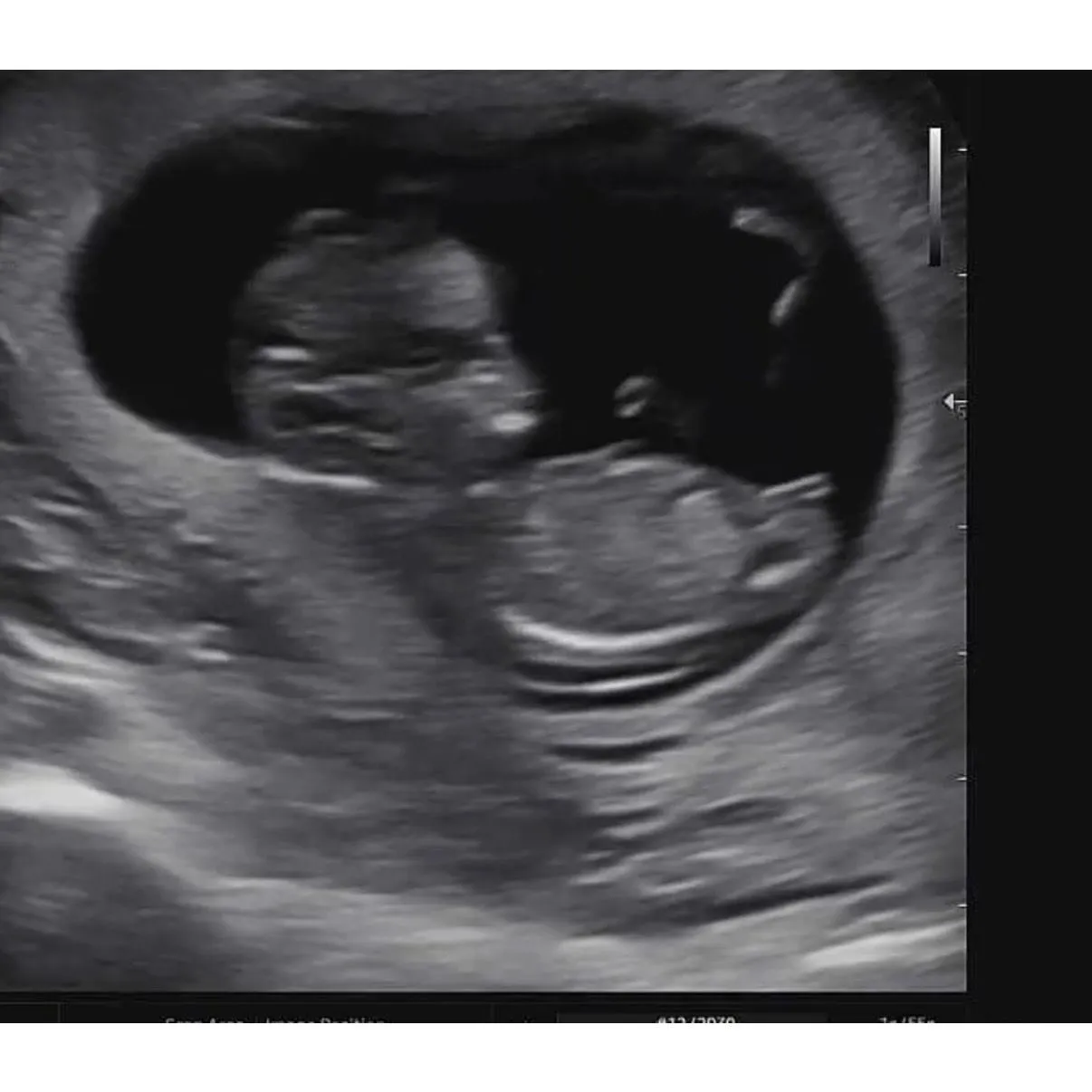 11주6일 각도법 투표해주세요!