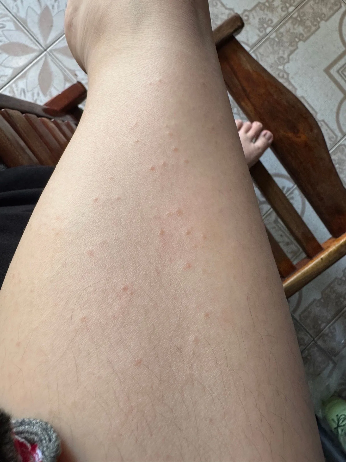 Có mom nào giống em k ạ 2