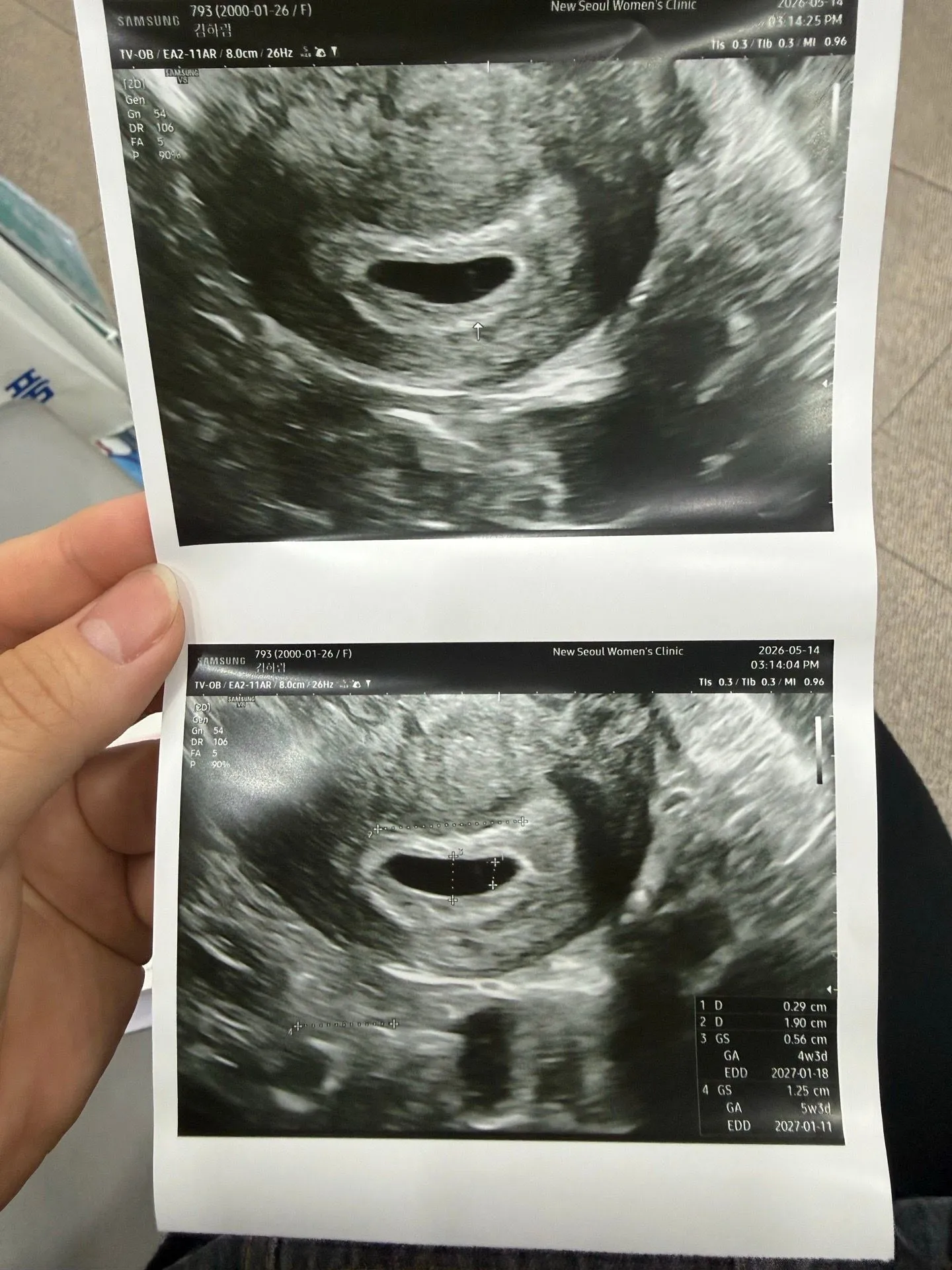 6주6일 예정일 1/1 일줄알고 병원방문..아기집크기 봐주세여  2