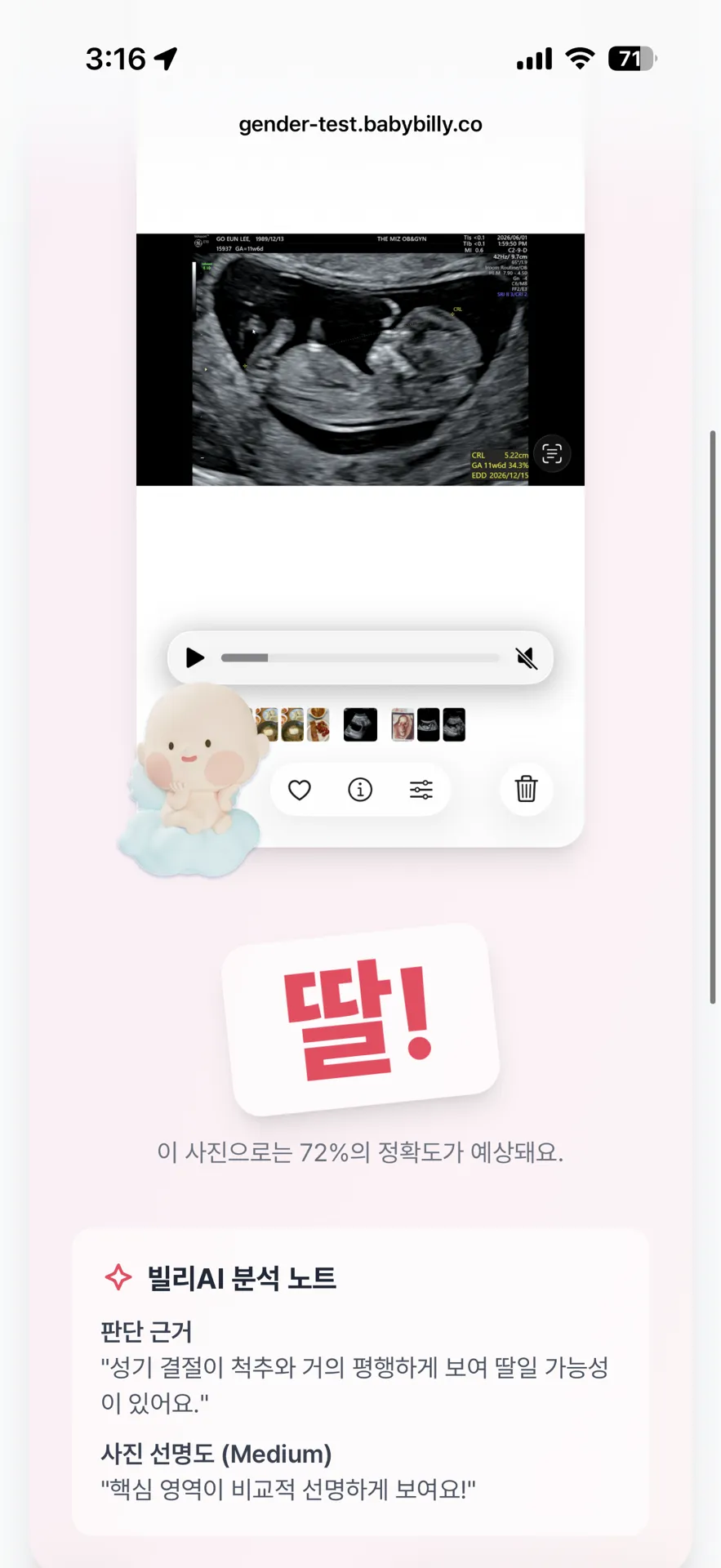 빌리 각도법 aiㅎㅎㅎㅎㅎㅎ 4