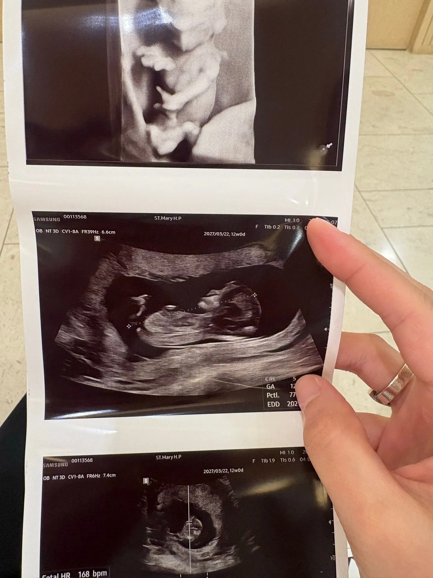 12주 0일 각도법 봐주실 분 계실까요?👶🏻💕 2