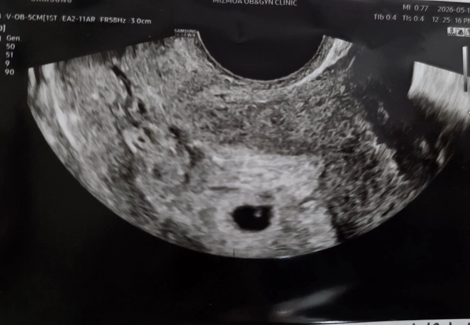애기가 더클수있겠죠?ㅠㅠ 1