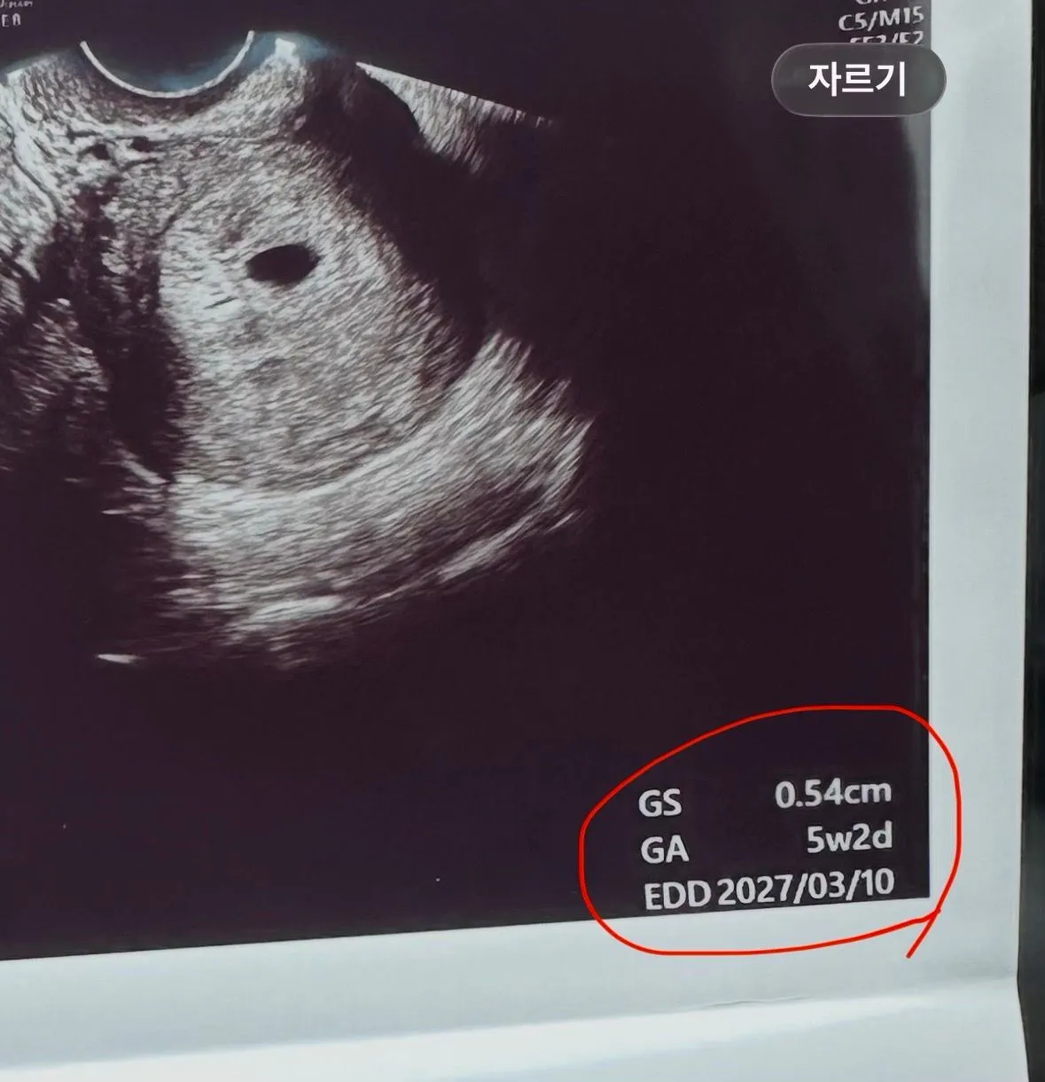 4주6일 아기집 보고 왔는데 주수보다 커요