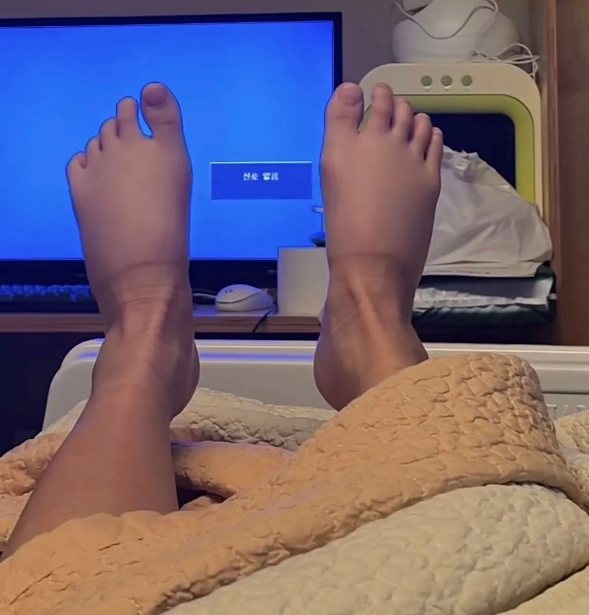 압박 스타킹 이런데 신어도 되는거에요..?