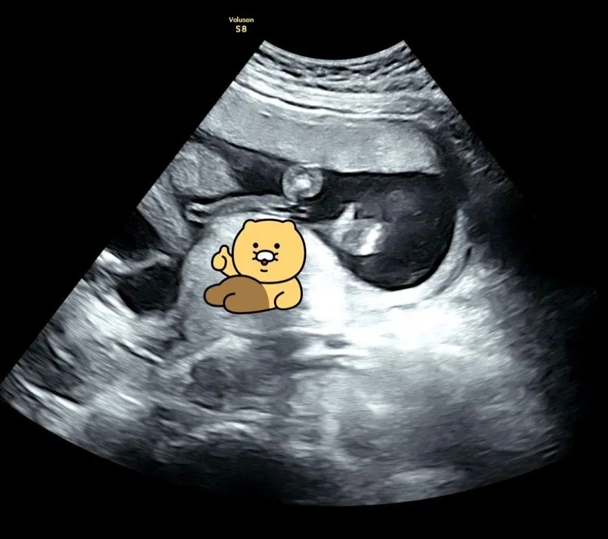 따봉 날려준 아기 초음파, 자꾸 보게돼요*_*