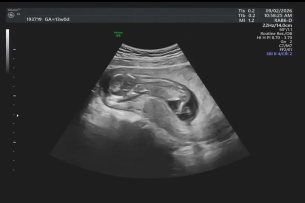 13주 1일차 성별 그리고 양수양이.. 2