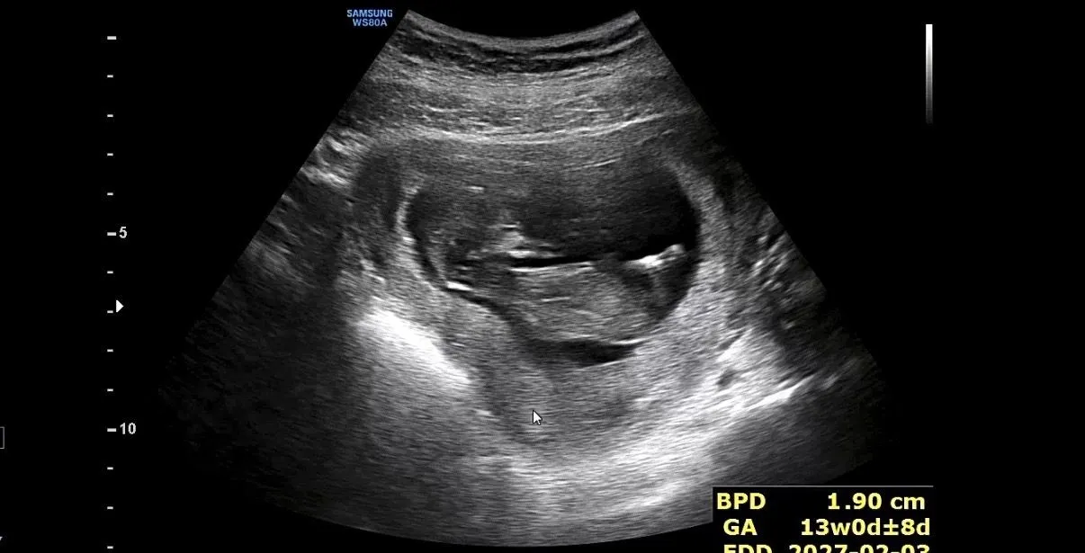 12 주차 예비 엄마예요. 저희 양말이는 딸일까요? 아들일까요? 3