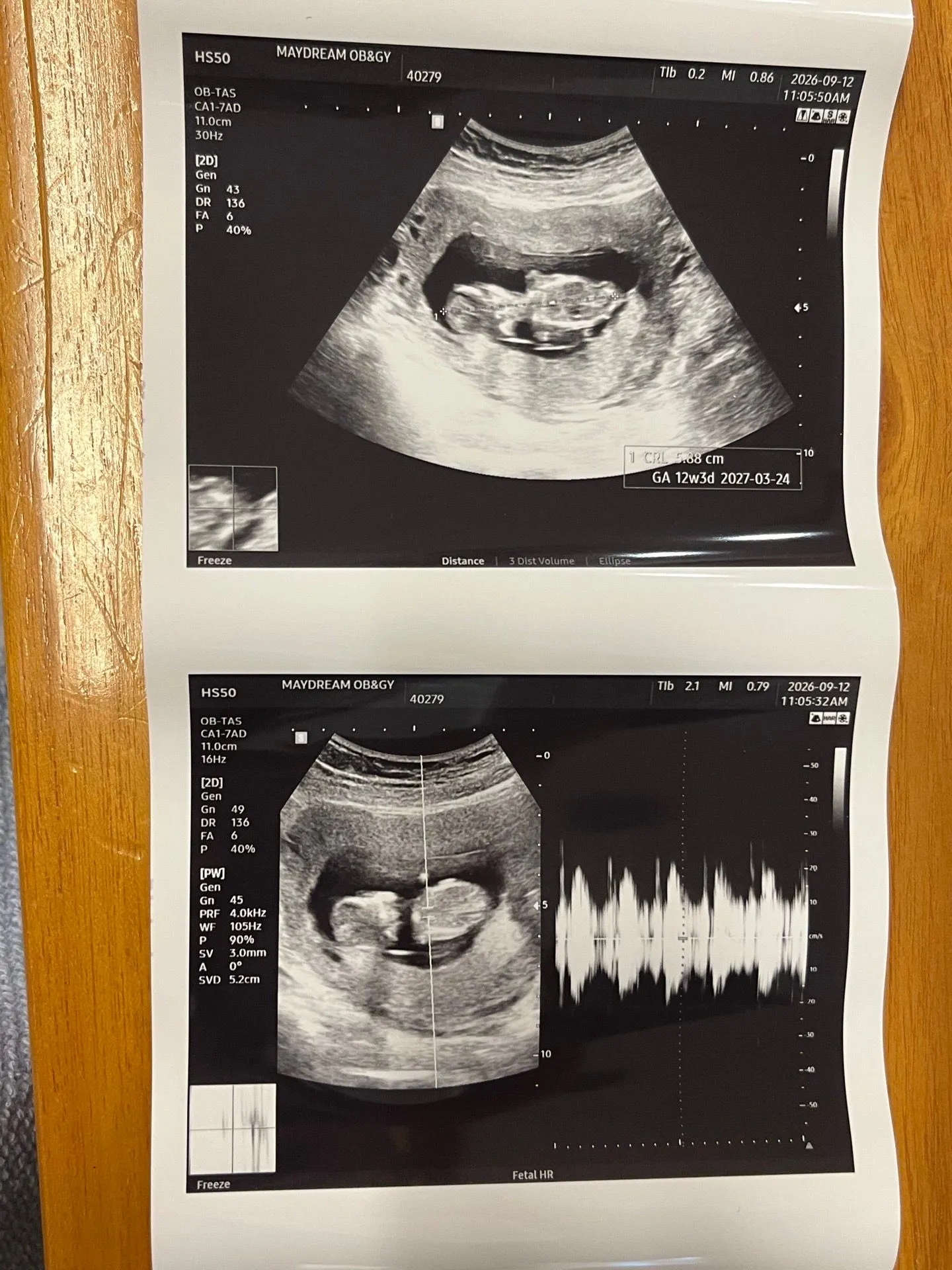 12주라해서 올려요 각도법 보일까요?☺️ 4