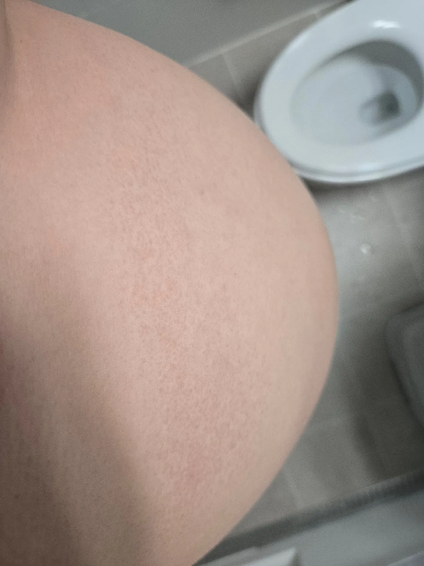 배에 뭐가 났는데 이게 뭘까요..?