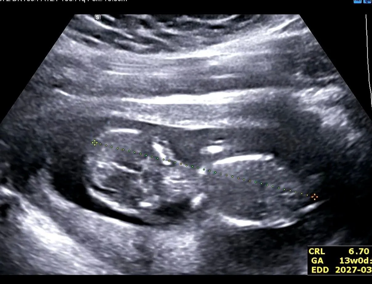 12주6일