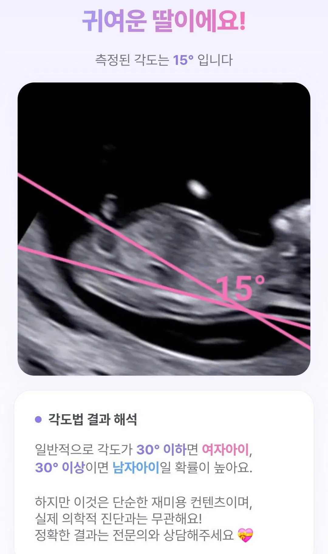 이정도면 딸 맞겠져?? ㅠㅠㅠㅠ 1